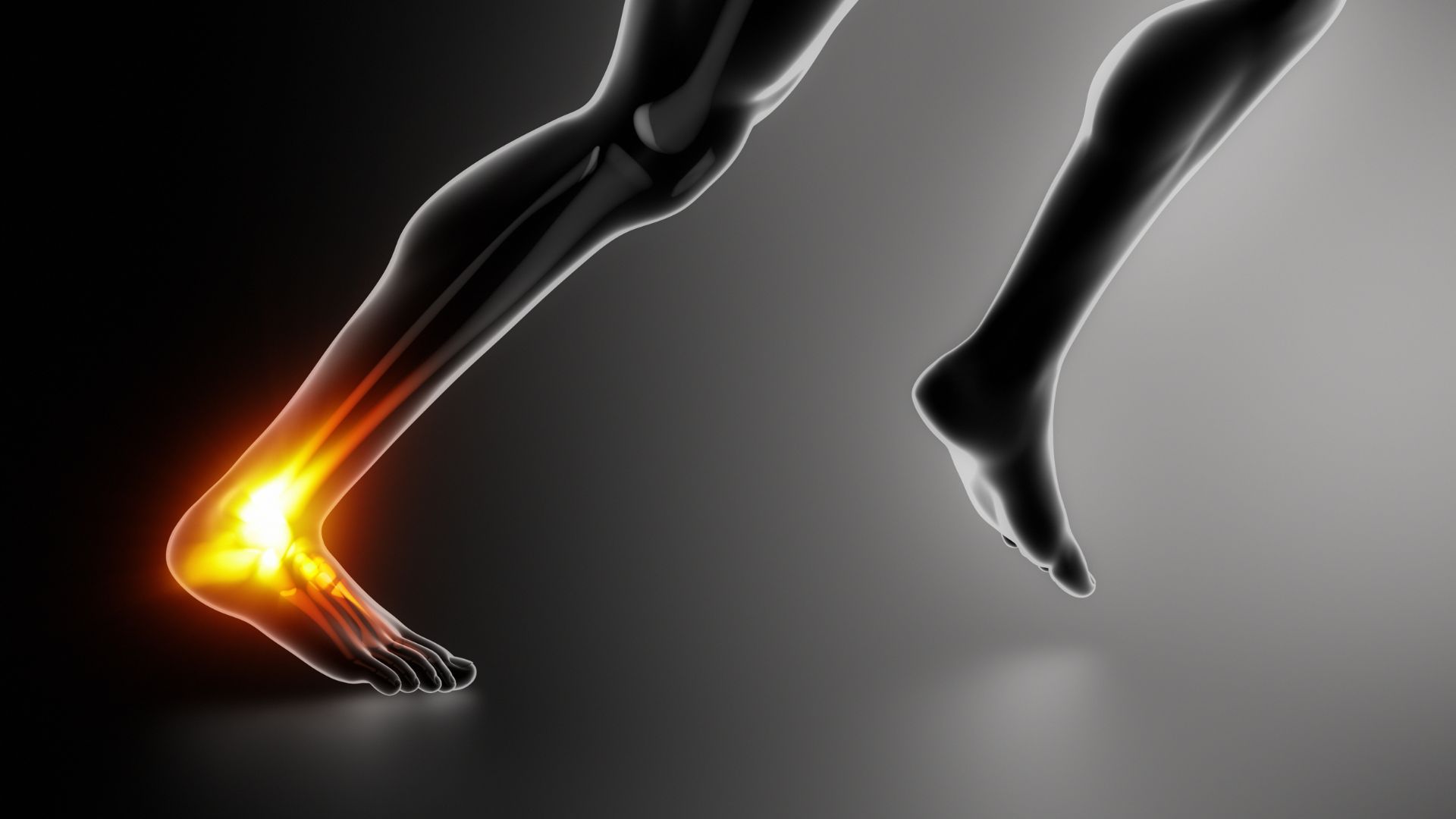 Achilles Tendinitis